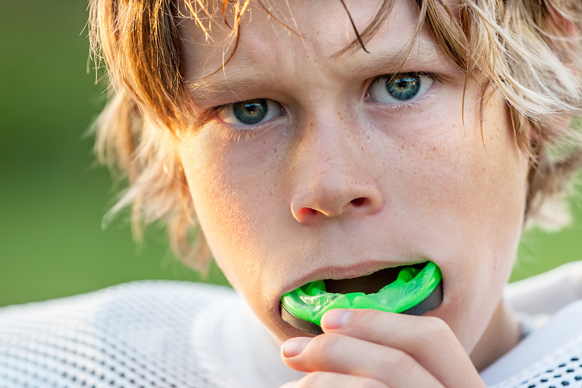 Protecting Your Smile: Why Stoney Creek Athletes Need Custom Mouthguards