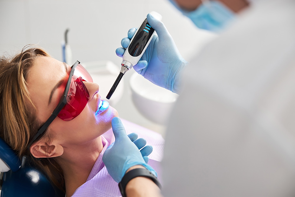 What are Dental Sealants?