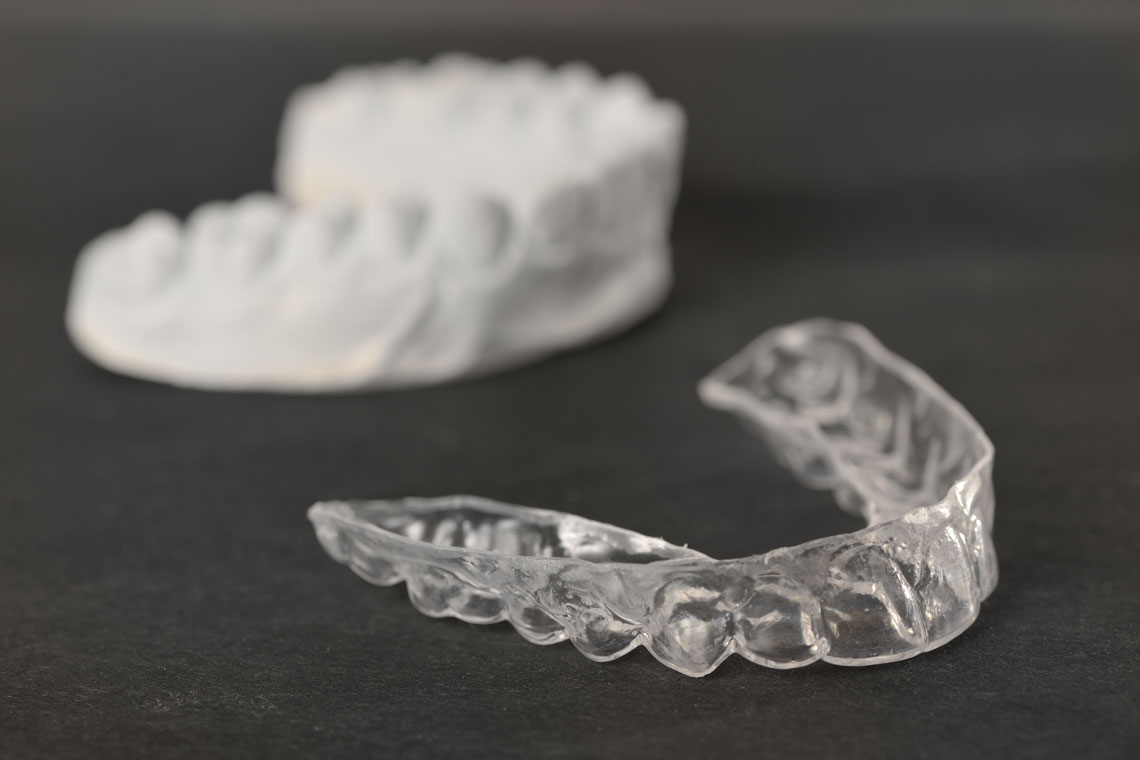 How Long Does it Take Invisalign to Work?