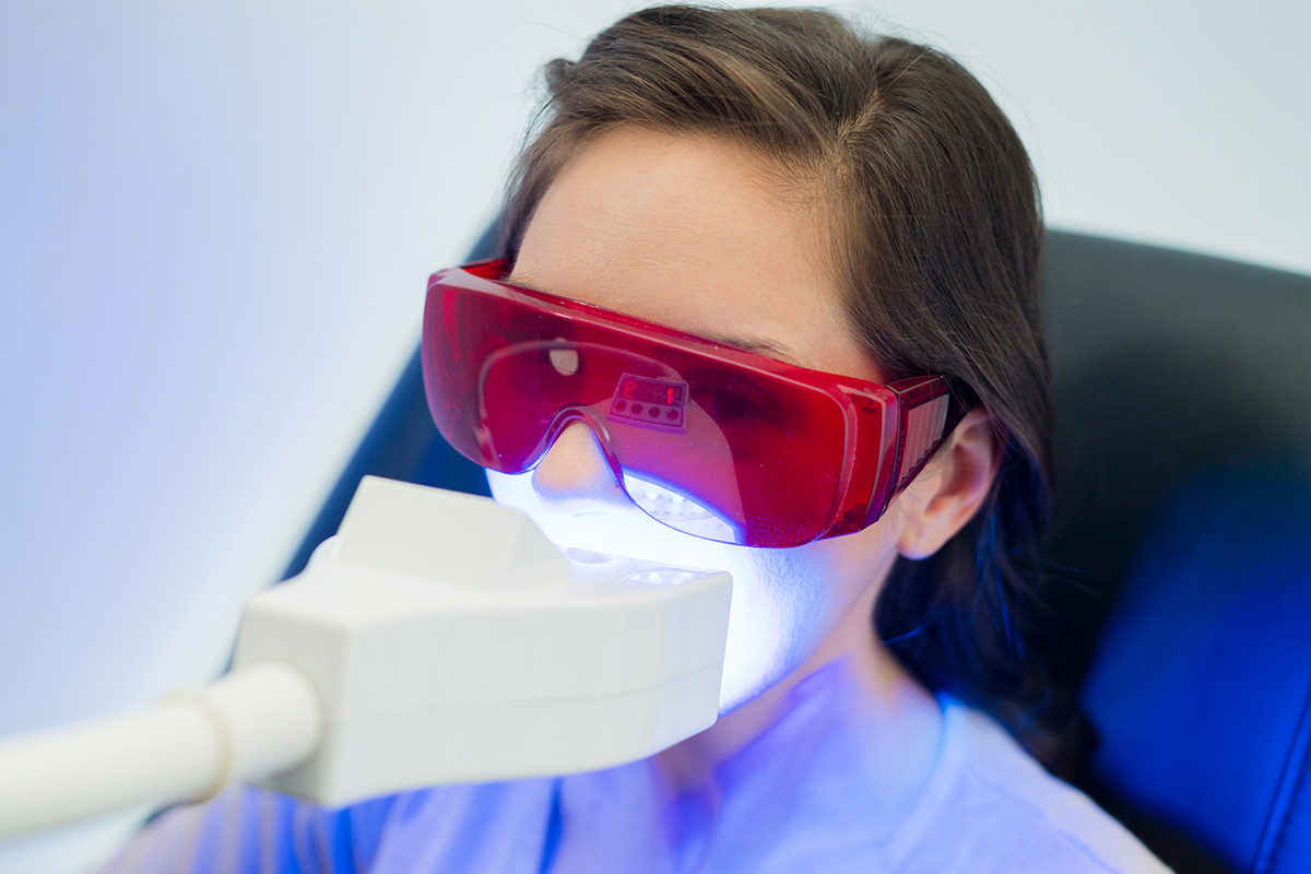 The Future of Teeth Whitening: Innovations and Trends
