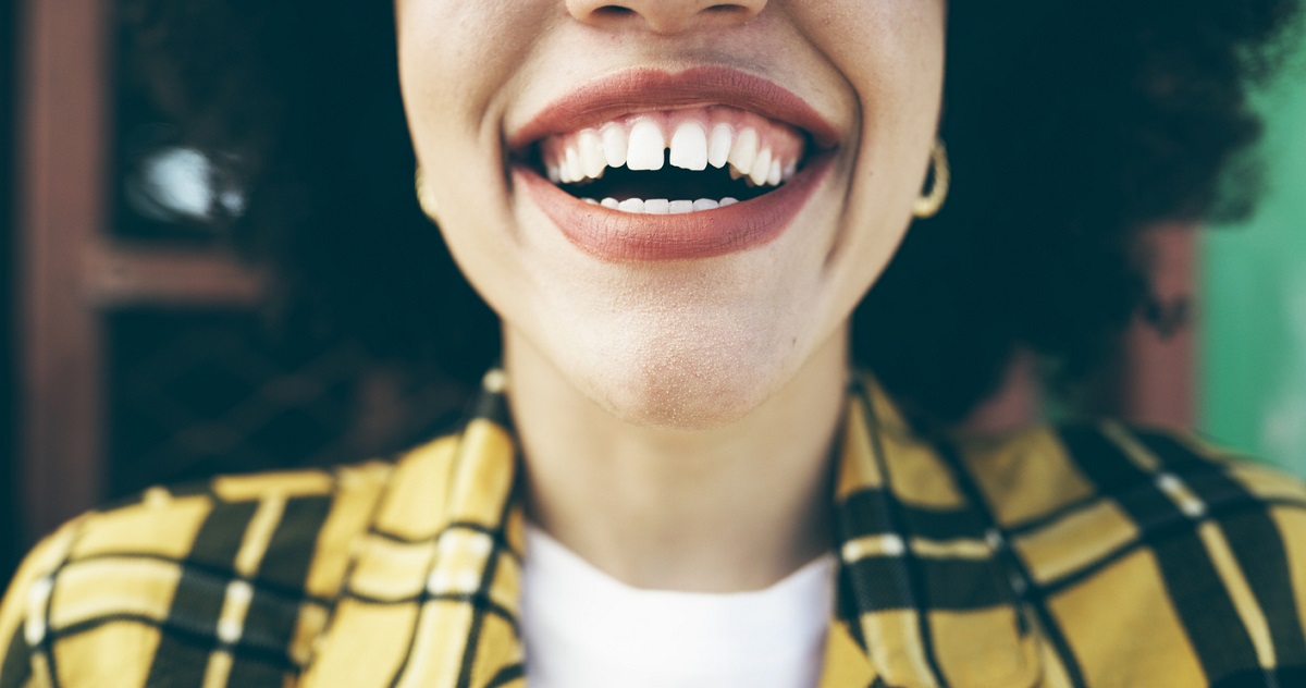 Gaps Between Teeth: Causes and Treatment