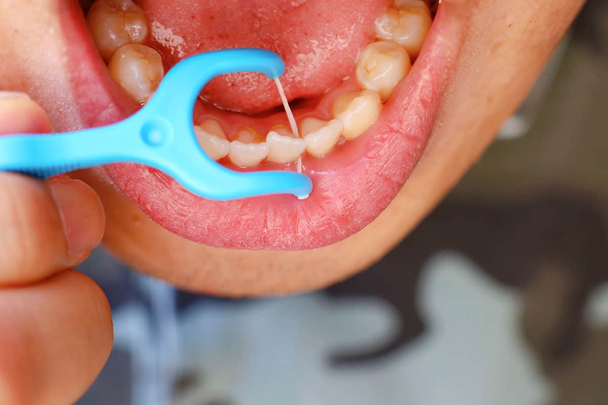Why You Should Smell the Floss (perio breath)