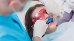Do I Need Fluoride Treatment?
