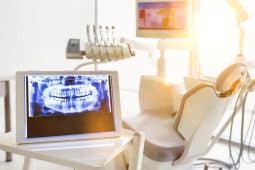 Common Wisdom Teeth Removal Questions